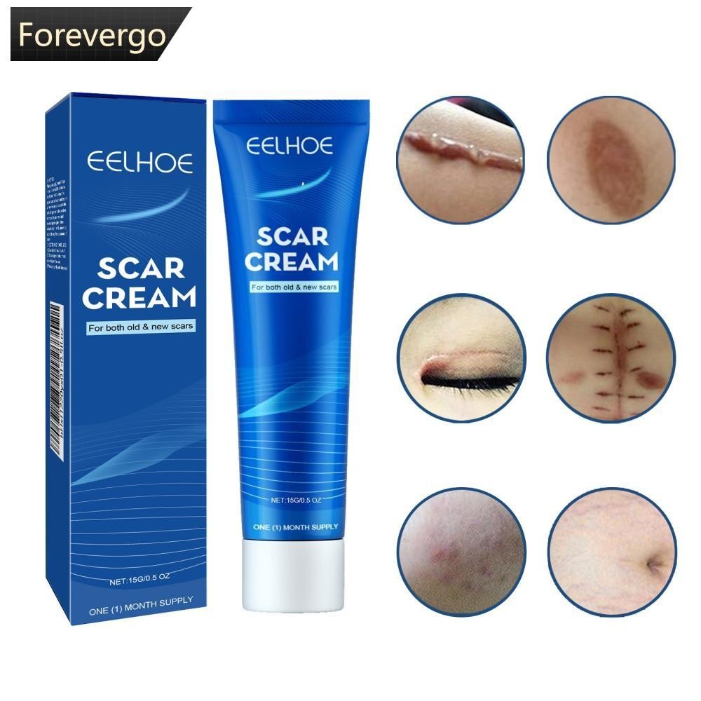 Forevergo Skin Repair Cream Scar Cream Care สําหรับ Scalds Burn Marks Acne Marks Fading and Smoothing Care Cream Scar Cream G4S9