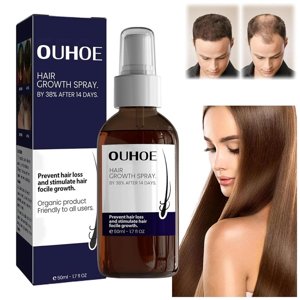 Ouhoe Hair Growth Spray Hair Growth Oil, Natural Hair Growth Spray Hair Growth สําหรับผู ้ ชายและผู ้ หญิงผมเพิ ่ ม Serum, เซรั ่ มผมสําหรับการเจริญเติบโตของเส ้ นผม
