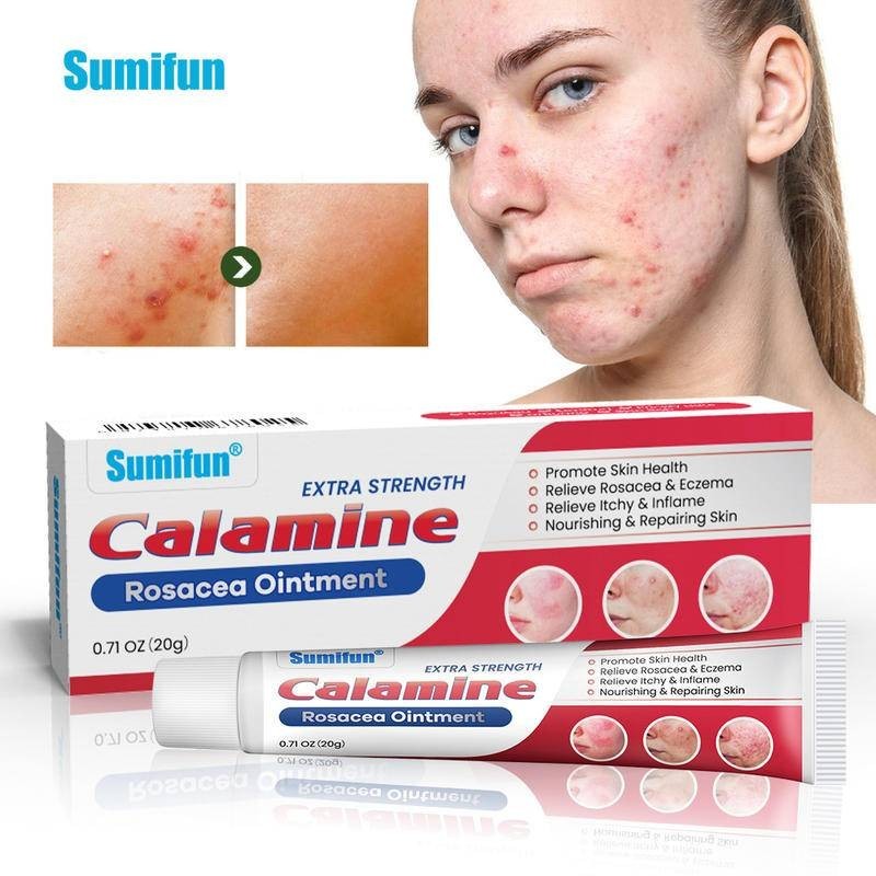 Extra Strength Calamine Rosacea Ointment Acne Repair Face Soothing Cream Pimple Treatment Skin Care 