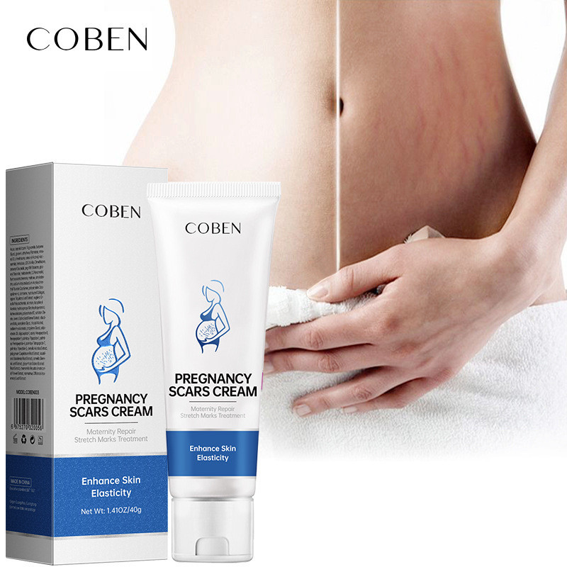 Spot Goods#COBENStretch Marks Recovery Cream Fade Stretch Mark Remove Pregnancy Marks Mummy Cream Prevent Stretch Marks Repair Scar Removal Ointment