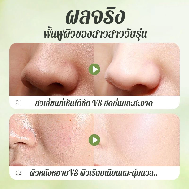 🔥1แถม1(12ซอง/กล่อง) 🔥สกินแคร์ มาส์กอโวคาโด้ ฟองฟู่ บํารุงผิวหน้า 10 วินาทีเกิดฟอง รูขุมขนหดตัว ทําความสะอาดรูขุมขนเติมความชุ่มชื้น สิวหัวดำที่สะอาด thumbnail 6