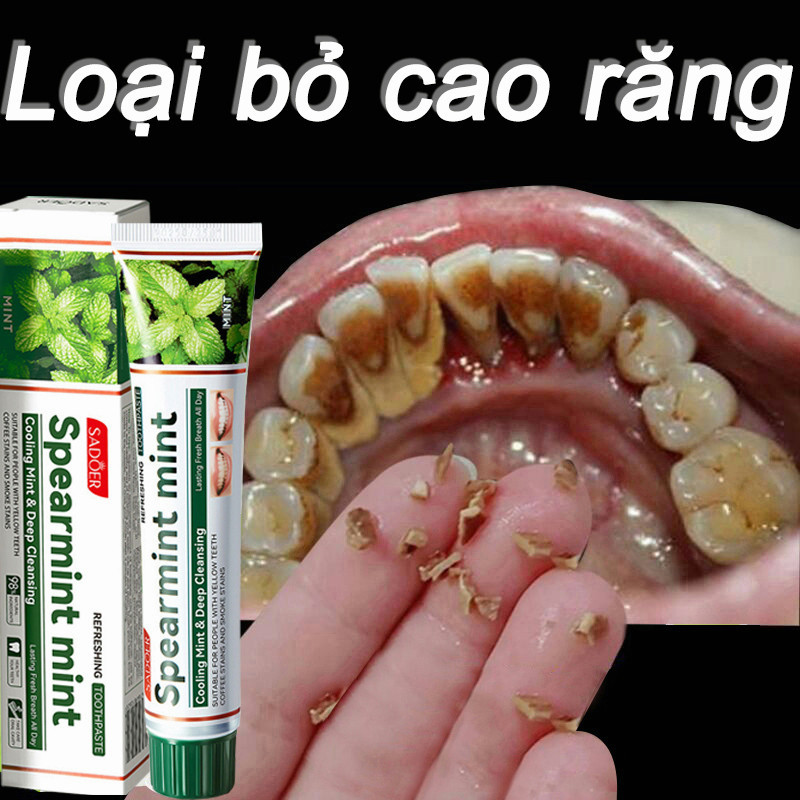 ซาเดอร์ วีซี ยาสีฟันไวท์เทนนิ่งทําความสะอาดหินปูนปกป้องเหงือกและปากสดชื่น