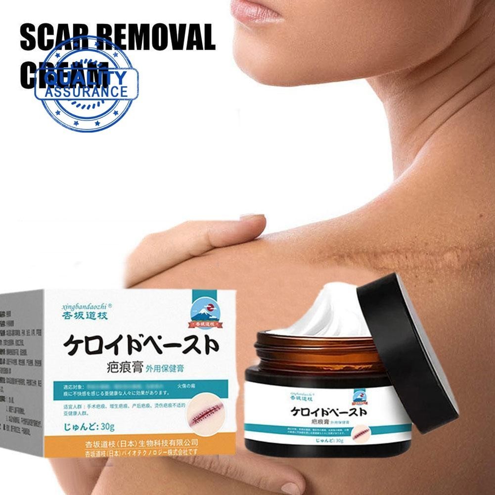 30g Anzusaka Michie Scar Cream External Health Care Cream Hyperplasia Burn Repair Scar Scar R5J1