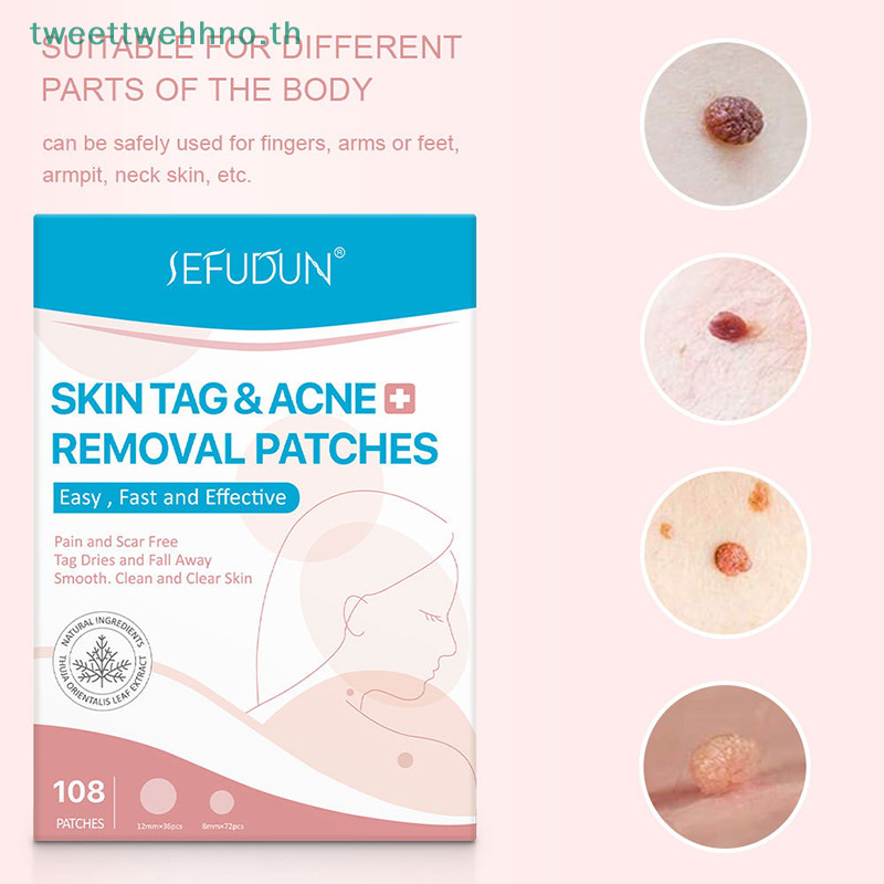 Tweettwehno 108pcs Skin Tag Remover Patch Hydrocolloid สิวสิว Moles Zits Warts TH
