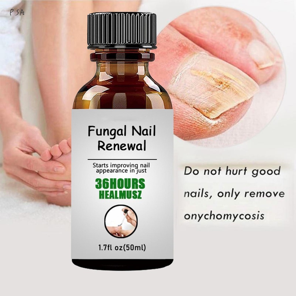 Anti Fungal Nail Repair Liquid ปลอดภัยและไม ่ เจ ็ บปวด Anti-Fungal Infection Toe Nursing Serum