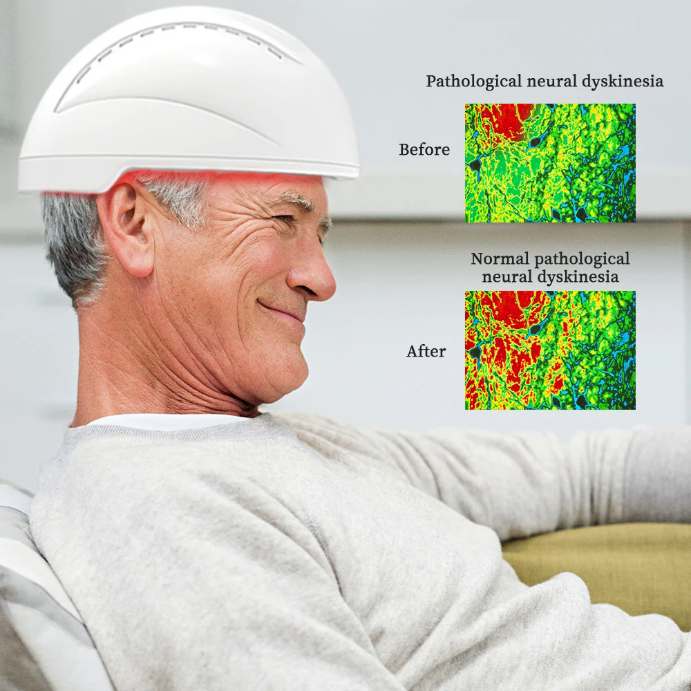 หมวกกันน็อคบำบัด810nm pbm หมวกกันน็อคอินฟราเรดแสงสีแดงหมวกออปติคอลควบคุมสมองอุปกรณ์พาร์คินสันอุปกรณ์