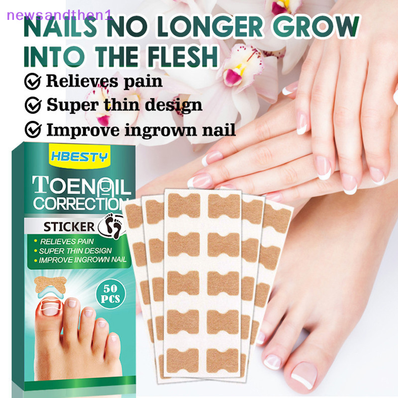 Newsandthen1 50 ชิ้น สติกเกอร์แก้ไขเล็บคุด รักษา Paronychia ฟื้นฟูแก้ไขเล็บเท้า เครื่องมือแก้ไขเล็บ สติกเกอร์ดูแลเล็บ Nice