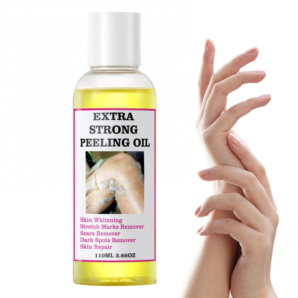 Yl น้ํามันลอกสีเหลืองสําหรับผิวคล้ํา Strong Peel Oil ความแรงพิเศษ, Exfoliating Chemical Exfoliant Peels Solution สําหรับขัดผิวมือเท้าประเภทผิวทั้งหมด