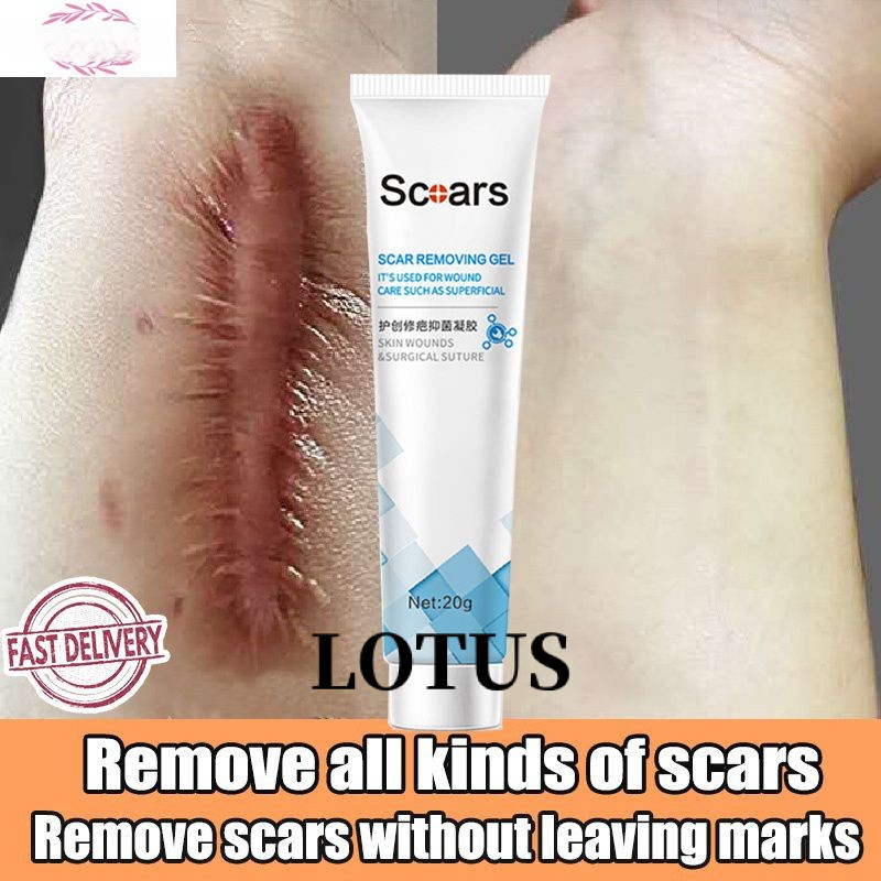 Jiujiutang Scar Repair gel Dilute Peklat Acne Treatment Cream Scar Repair Cream 20g Livebecool