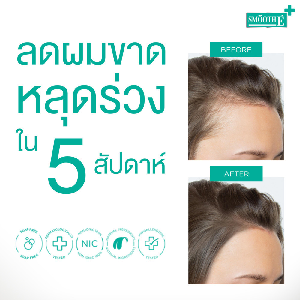 Smooth E Extra Duo Anti Hair Loss Set เซตบำรุงผม หยุดผมร่วง รักษาหนังศีรษะมัน เพิ่มผมหนา - รูปที่ 4