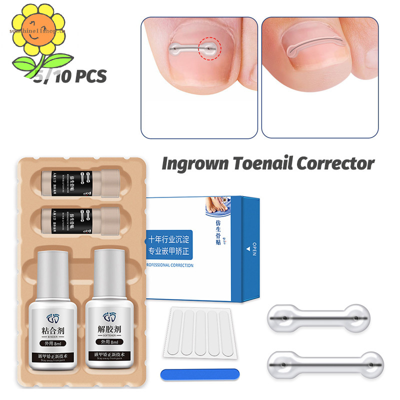 SUNSHOP คุด Toenail Corrector เครื่องมือ Pedicure Recovered Toe Nail Treatment คุด Toenail Straightening คลิปรั้ง TH