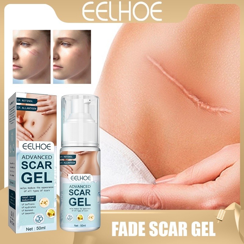 Eehoe Advanced SCAR GEL Repair Cream for mederma SCAR removal &amp; stretch Mark Treatment (50 ml/box)