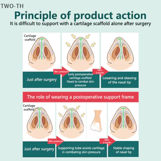 Two-th หลังผ ่ าตัดจมูกสนับสนุนซิลิโคน Shaping Crooked Nose Correction Fixator ซิลิกาเจลคลิปจมูกใหม ่