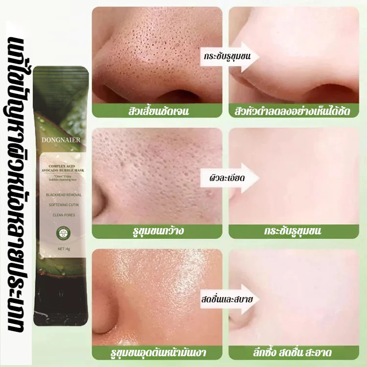 🔥1แถม1(12ซอง/กล่อง) 🔥สกินแคร์ มาส์กอโวคาโด้ ฟองฟู่ บํารุงผิวหน้า 10 วินาทีเกิดฟอง รูขุมขนหดตัว ทําความสะอาดรูขุมขนเติมความชุ่มชื้น สิวหัวดำที่สะอาด thumbnail 5