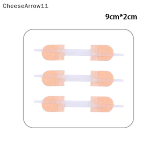 Che Zipper Tie Wound Closure Patch Hemostatic Patch Wound Fast Suture Zipper Band TH