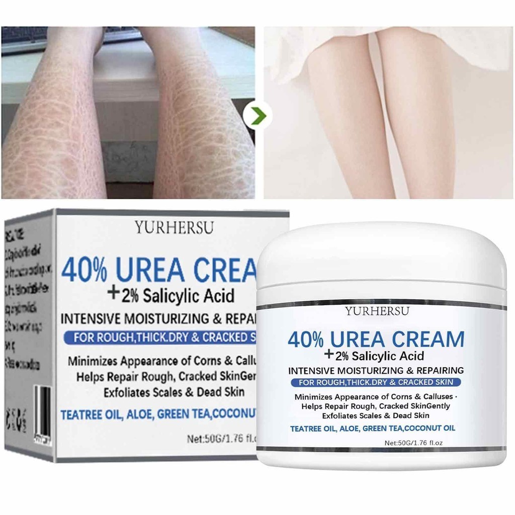 ธรรมชาติมือ Moisturizer ครีมยูเรีย 40 ครีมฟุตแคลลัสลบครีม Body Repairing ครีม Salicylic Acid 2 Freeze Protection teith
