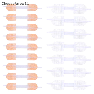 Che Zipper Tie Wound Closure Patch Hemostatic Patch Wound Fast Suture Zipper Band TH