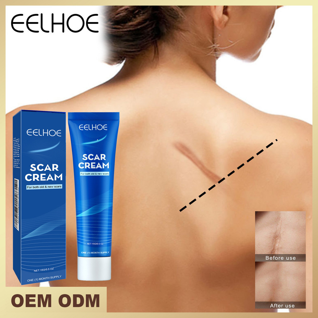 Spot Goods#eelhoeSkin Repairing Cream Scar Removal Ointment Care Scald Burn Marks Acne Marks Fade Smooth Care Cream Scar Removal Ointment5vv