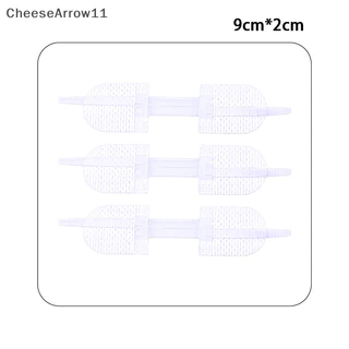 Che Zipper Tie Wound Closure Patch Hemostatic Patch Wound Fast Suture Zipper Band TH