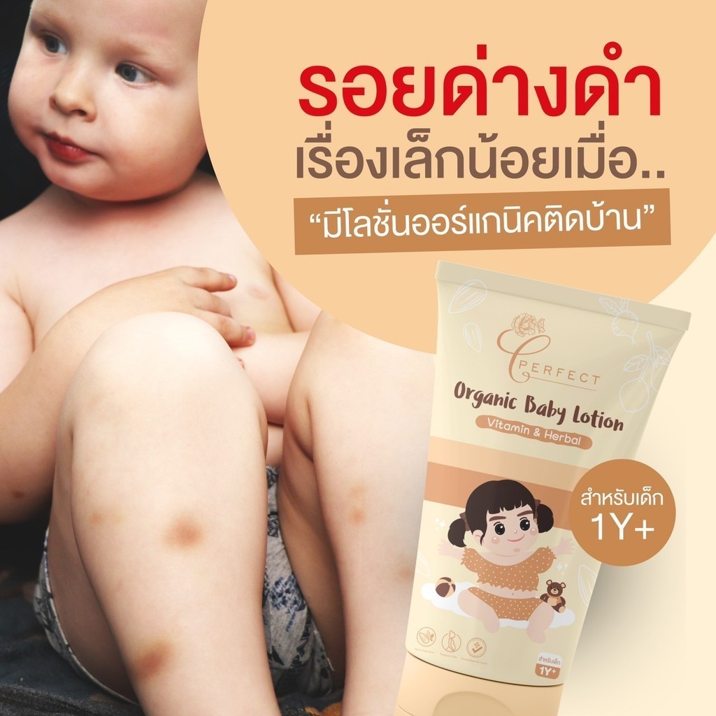 (ร้านค้าบริษัท) โลชั่นเด็ก ลดจุดด่างดำ ขาลาย รอยยุงกัด รอบขีดข่วน รอยแผลเป็น ผิวคล้ำเสีย