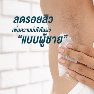 Nakiz Lively Butt For Men Clear Acne Spot Cream 100g นาคิส ครีมบำรุงผิว.