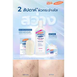 (แพ็ค 2) Palmer's โลชั่นบำรุงผิวขาว Skin Anti-Dark Spot Success Fade Milk Lotion 250ml. ลดรอยดำ ผิวคล้ำ ให้กลับมาขาว