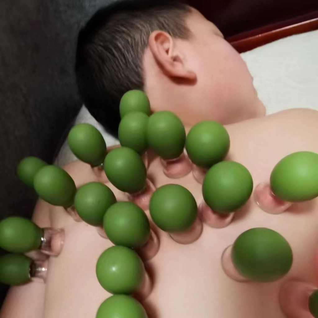 การแพทย์แผนจีนหลอดบําบัดป้องเครื่องมือปรับสภาพใบหน้าบรรจุผิวเดินสามารถขูดใบหน้าเครื่องมือที่มีประโยชน์หัวก๊าซสามารถลบความดัน24.6