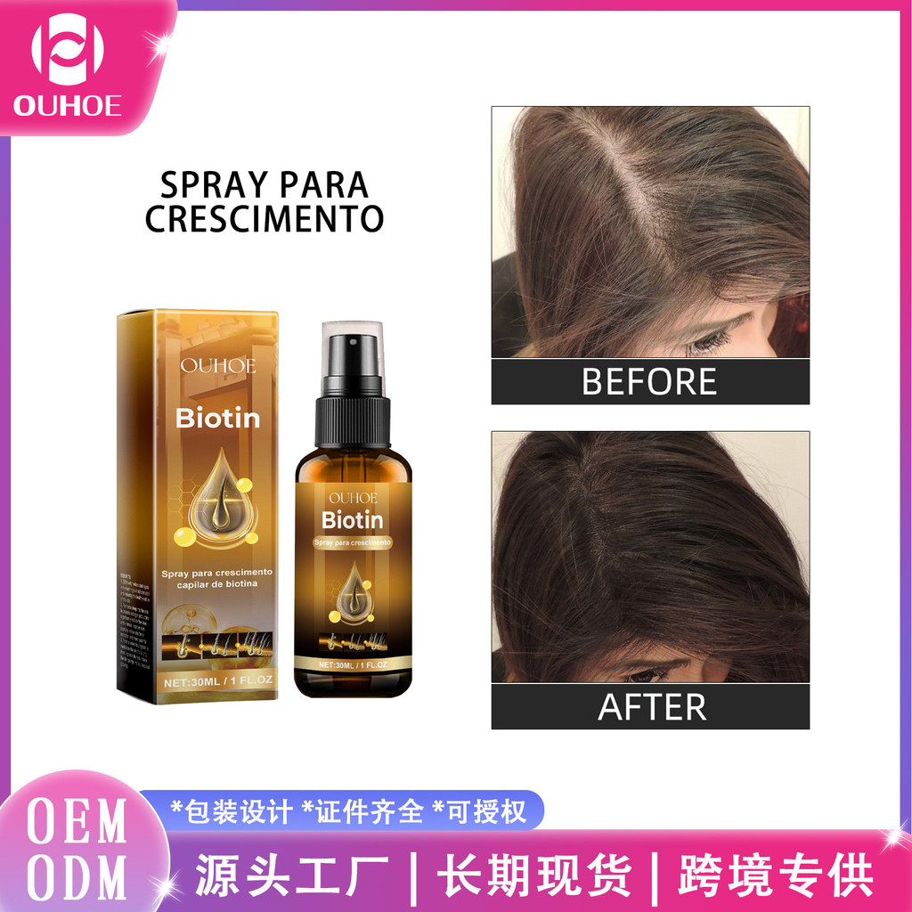 มาใหม่ทุกวัน/OUHOE สเปรย์บํารุงหนังศีรษะ Strong Hair Moisturizing Hair Scalp Care Plant Extract Care