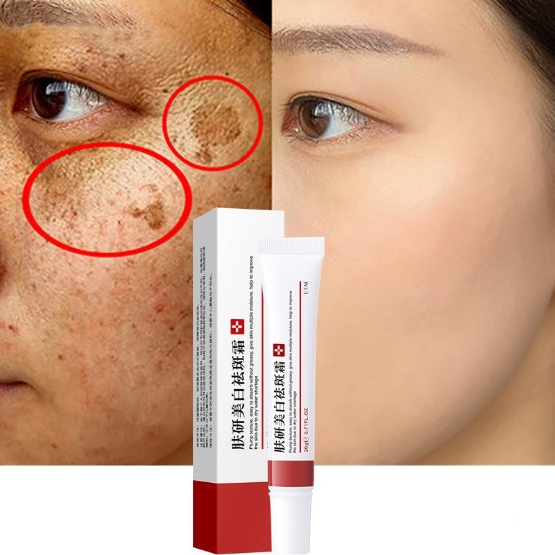 ครีมไวท์เทนนิ่งกระลบฝ้าครีมลบจุดด่างดําเมลานิน Melasma Remover ผิวกระจ่างใส Anti-Aging Skin Lightening