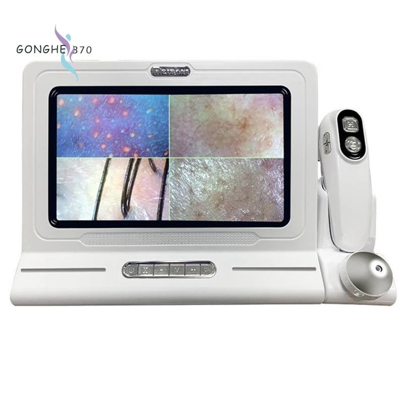 [gonghe370] เครื่องวิเคราะห์หนังศีรษะ กล้องจุลทรรศน์ดิจิทัล LCD ขนาด 11 นิ้ว สําหรับตรวจหนังศีรษะ สิวหัวดํา รูขุมขน