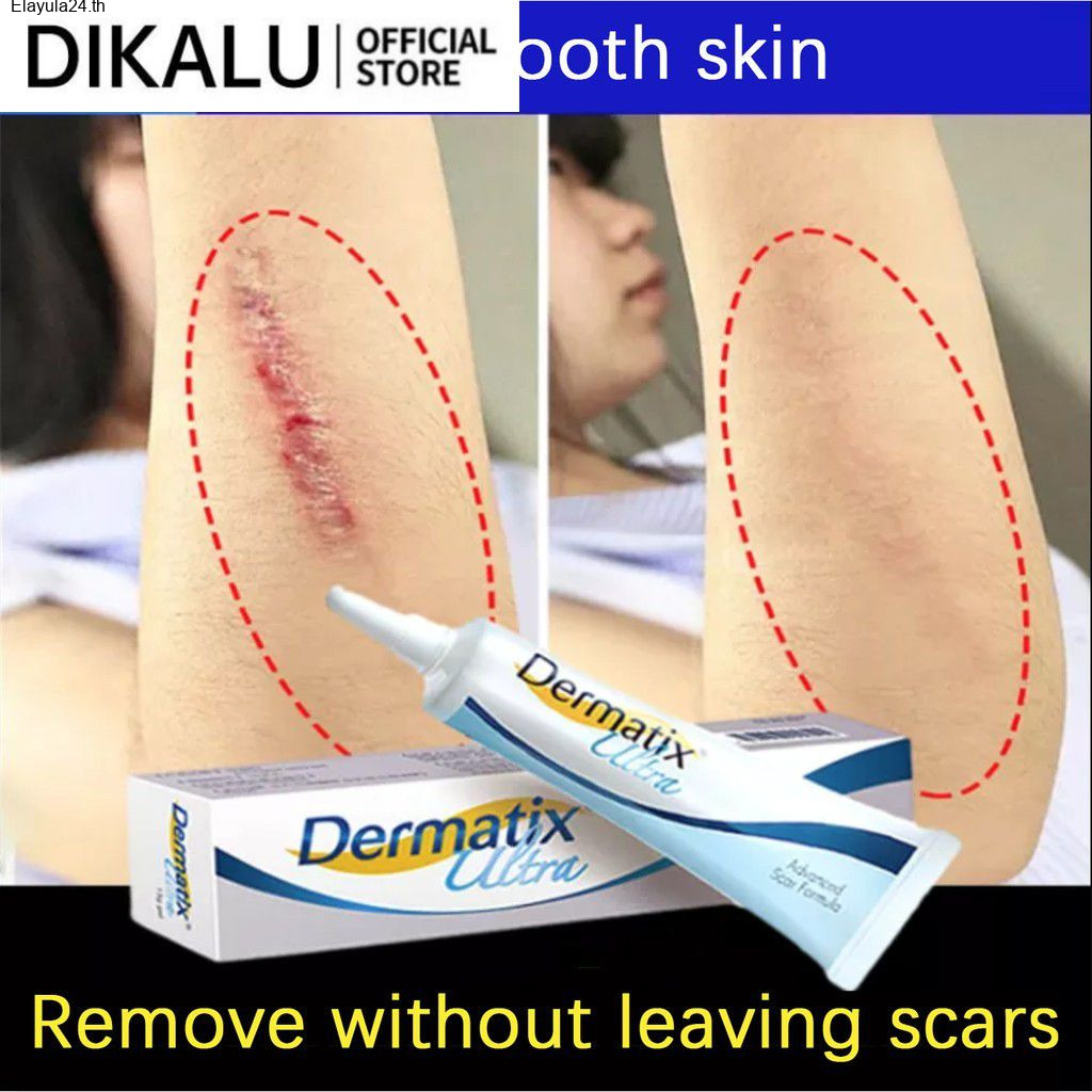 Elayula24.thdikalu Dermatix Scar Removal Cream, ใช ้ ลบสิว/restore ผิวไหม ้