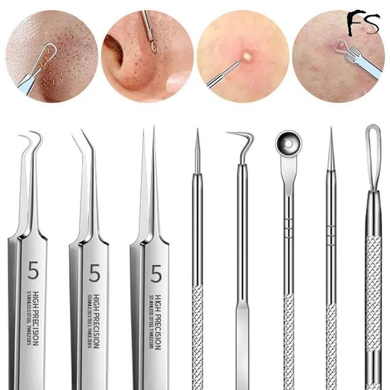 สิวหัวดํา Remover บีบสิวเข็มแหนบ Aema สิวหัวดําเซลล์คลิป 5 Extractor สิว Comedon จุดสีดําจมูก Sebum เครื่องมือ