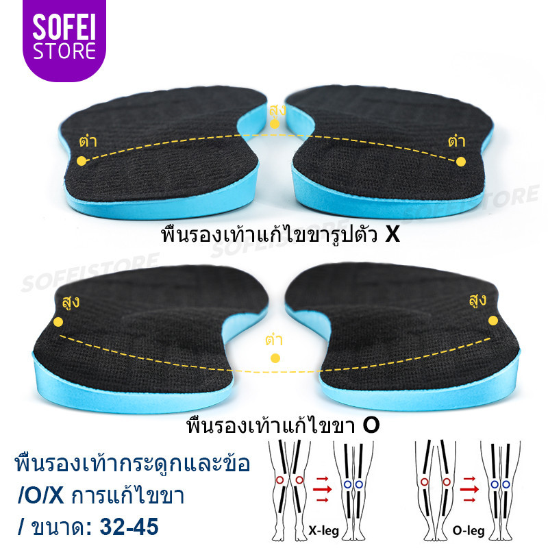 O/X ขา พื้นรองเท้าด้านในรองรับส่วนโค้งของกระดูกเท้าแบน