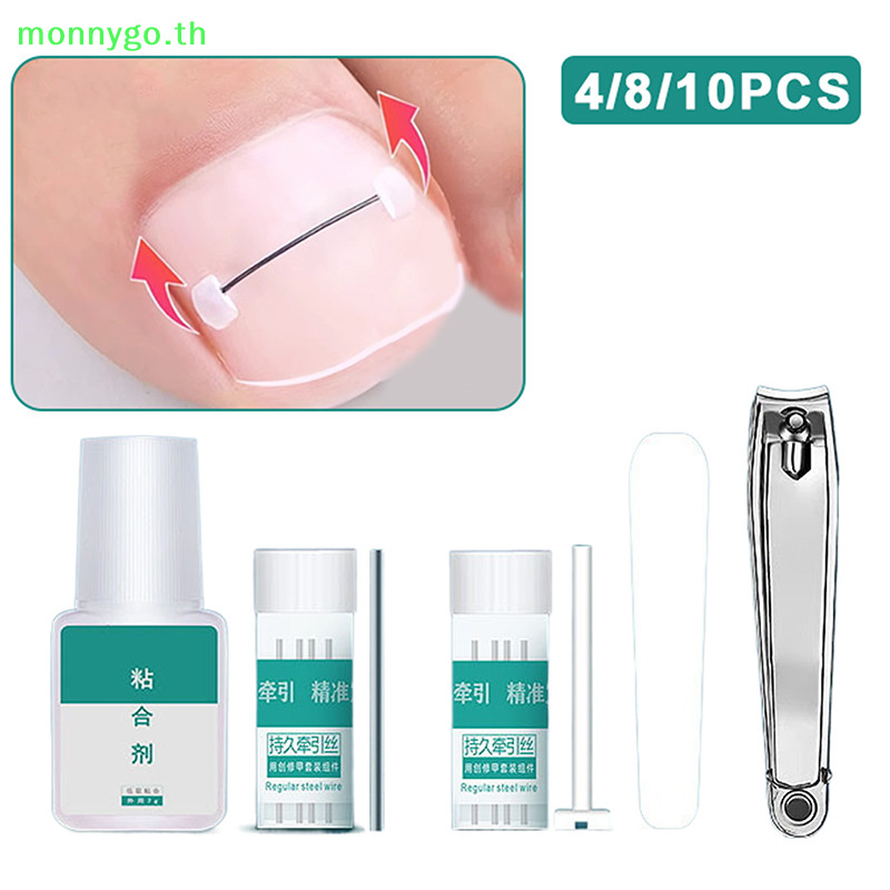 Monnygo คุด Toenail Corrector เครื่องมือ Pedicure Recover ปัก Toe Nail Treatment คุด Toenail Straightening คลิปรั้ง TH