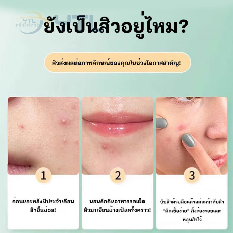 YTL แผ่นแปะสิวรูปดาว แผ่นแปะสิว ขอบบาง กันน้ำ แต่งหน้าเนียน ปกปิดรอยสิว ใช้ได้กับทุกสภาพผิว กันน้ำ ดูแลผิวหน้า 40 ชิ้น - รูปที่ 2