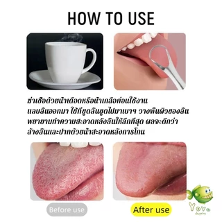 YOYO ที่ขูดลิ้น สเตนเลส รูปตัว U เซตขูด เคลือบ แบบพกพา พร้อมส่งในไทย tongue cleaning