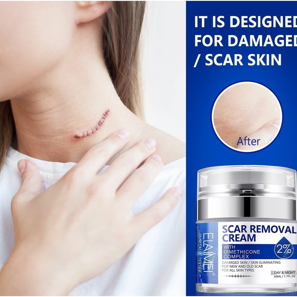 New Product#ELAIMEIPressing Scar CreamScarCreamStretch Marks Scald Caesarian Section Scars Removing Cream50ML4wu