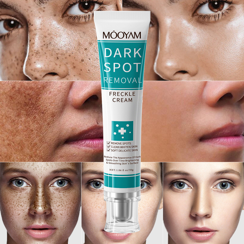 MOOYAM ครีมกําจัดฝ้ากระไวท์เทนนิ่ง Fade Spots อ่อนโยนลบฝ้ากระจุดอายุ Chloasma Repair Cream