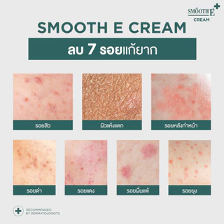 Smooth E Cream 10g. สมูท อี ครีมลดเลือนริ้วรอย ผื่นแดง รอยหัตถการ รอยแผลเป็น จุดดำจากสิว ผิวชุ่มชื้น