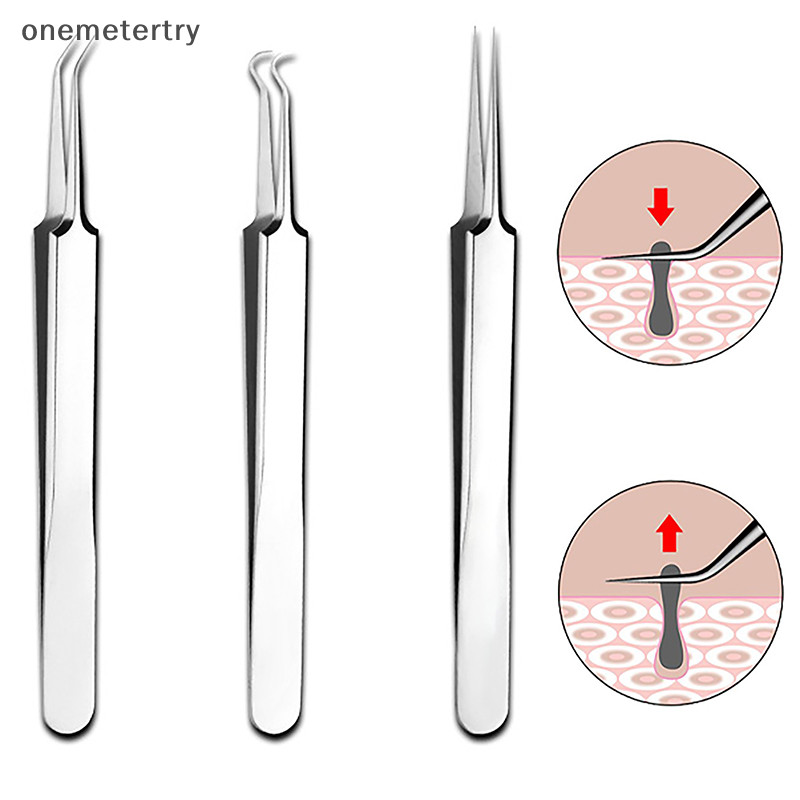 Onem 8 ซม.เซลล์สิว Blackhead คลิปแหนบร้านเสริมสวยพิเศษขูดปิด Artifact สิวเครื่องมือ n
