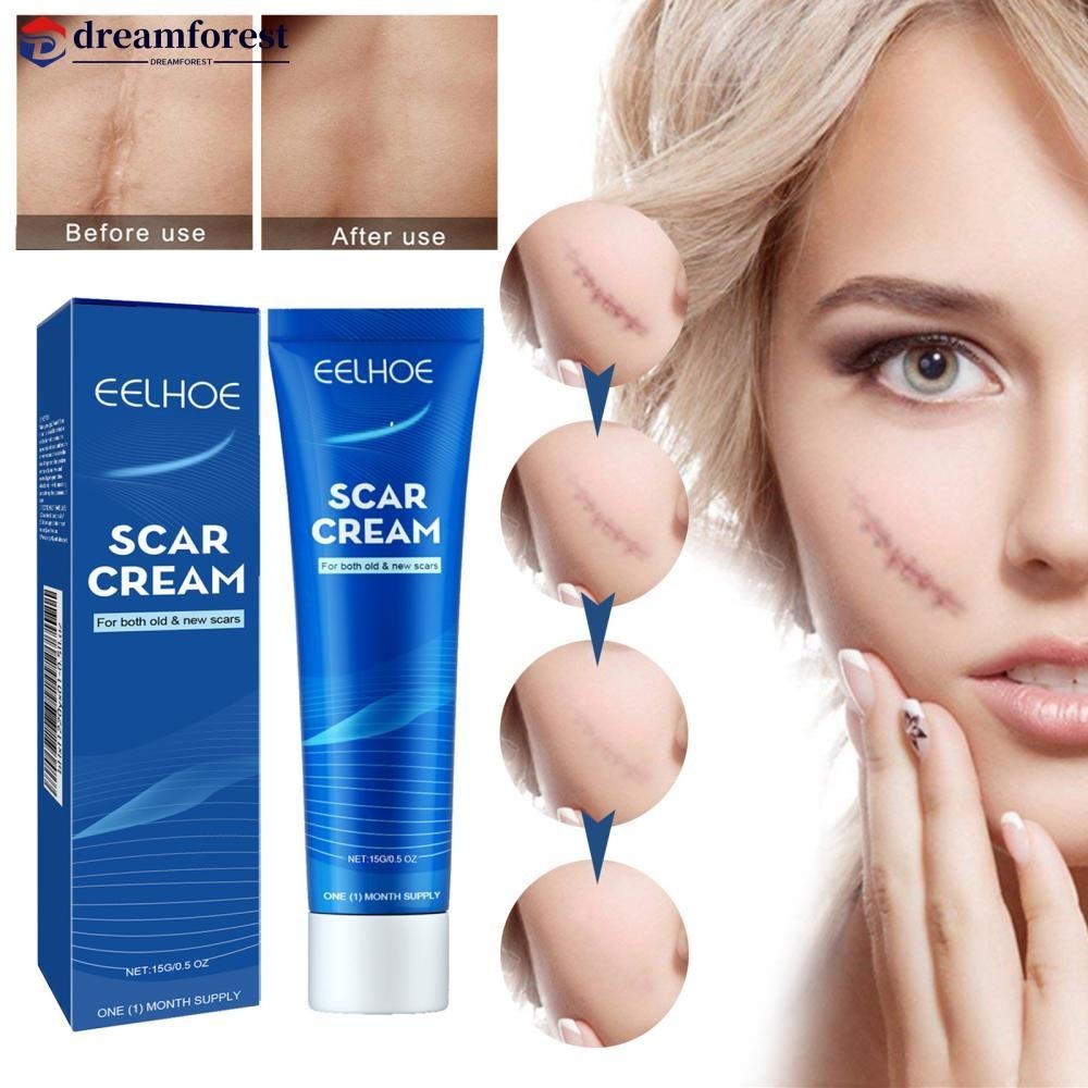 Dreamforest Skin Repair Cream Scar Cream Care สําหรับ Scalds Burn Marks Acne Marks Fading and Smoothing Care Cream ครีมแผลเป ็ น B5Y9