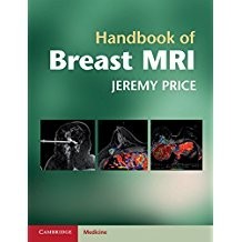 คู่มือเต้านม Mri****