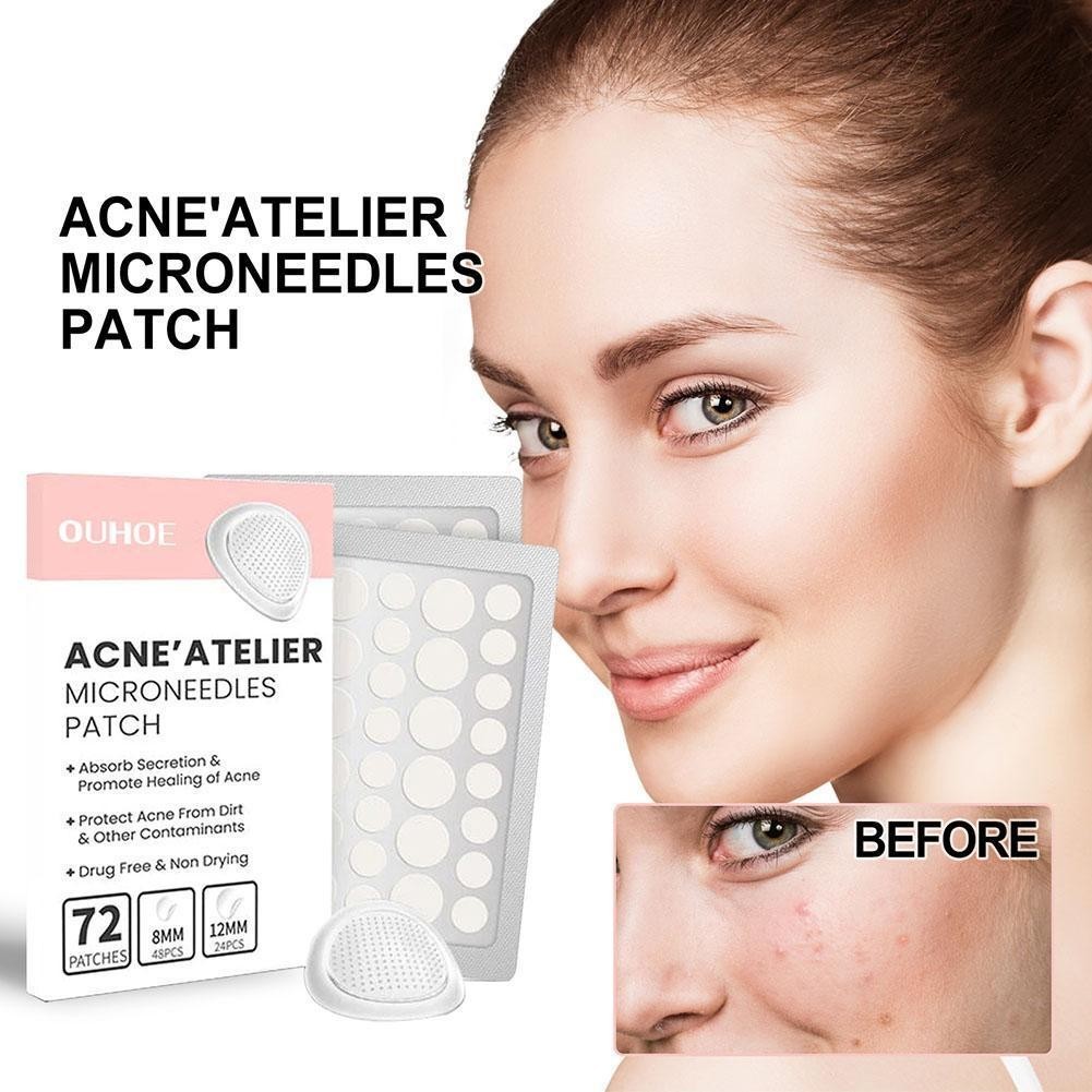 Microneedle Acne Patch สําหรับ Acne Treatment Care Blemish Removal Patch เหมาะสําหรับสิว Prone Skin