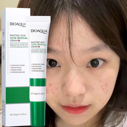BIOAOUA Salicylic Acid ครีมกําจัดสิว Hydrating ลดรอยสิว Repair Shrink Pore Cream ครีมกําจัดสิว