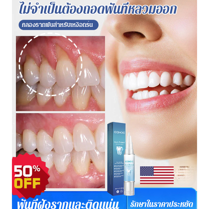 🌴【คุณภาพสูง】เจลซ่อมแซมฟัน ฟันขาวขึ้น ขจัดคราบหินปูน ลมหายใจหอมสดชื่น บรรเทาอาการเหงือกบวมและปวด เจลซ่อมแซมฟันที่สะอาดล้ำลึก