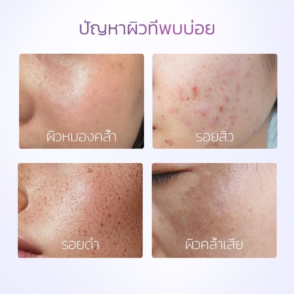 [Ready] SKINTIFIC Symwhite 377 เซรั่ม เซรั่มลดเลือนจุดด่างดำ（เซรั่มลดฝ้าแดด ฝ้าสะสม กระ จุดด่างดำ เพื่อผิวหน้ากระจ่างใส）