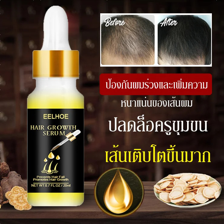 💎โปร 1 แถม 1💎น้ำมันขิงบำรุงผม ช่วยปลูกผม น้ํามันเอสเซ้นส์ดูแลเส้นผมขิงสําหรับระเบียบอย่างล้ําลึก ซ่อมแซมอย่างล้ําลึก ซ่อมแซมเส้นผม