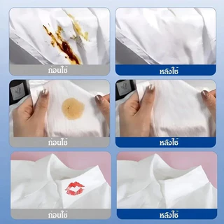 Ionic น้ํายาทําความสะอาดเสื้อผ้า คราบสกปรก