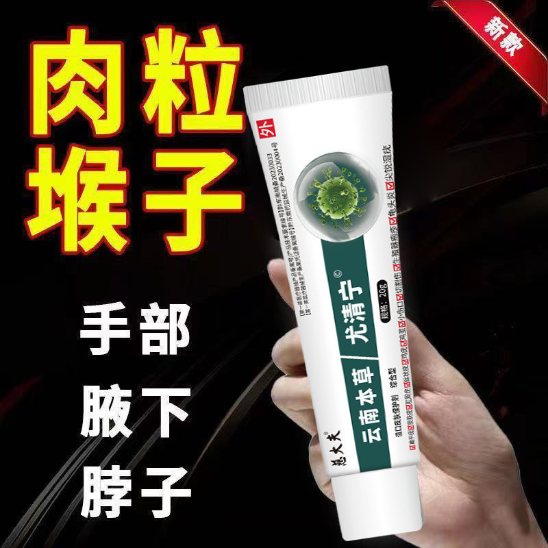 Yunnnan Materia Medica You Qingning Gel Flat Wart Removal Cream Filamented Wart Removal Cream เนื้อข