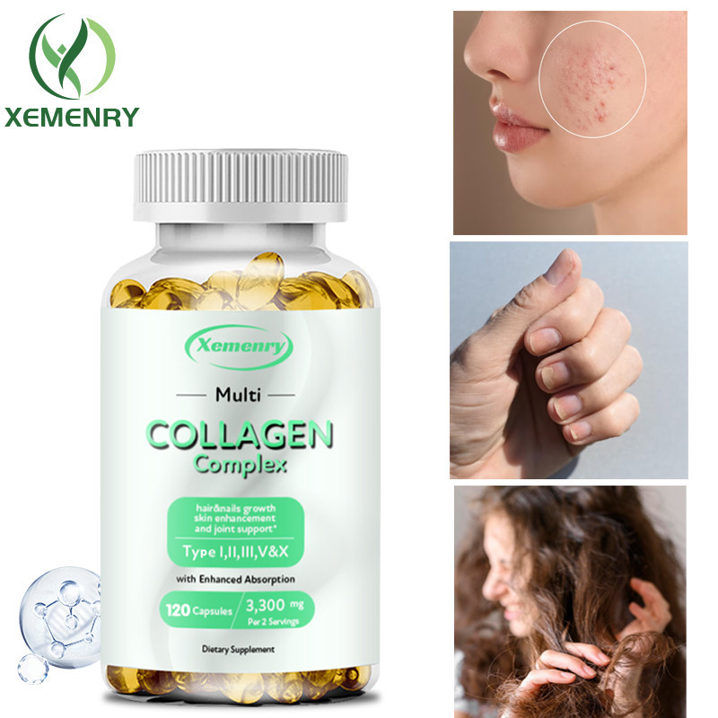 Xemenry Collagen Complex - ประเภท I, II, III, V, X - Hydrolyzed Collagen, Anti-Aging